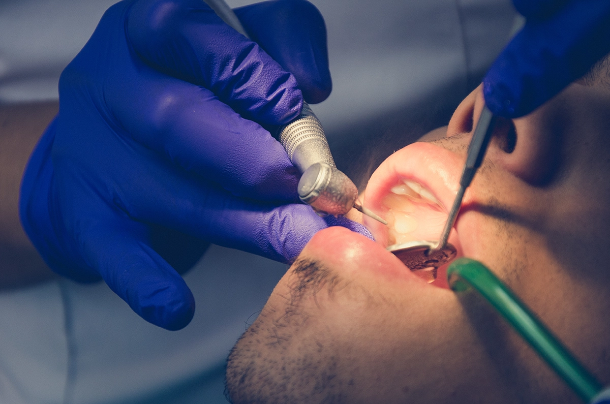 clinica dental salud bucal espana featured 65