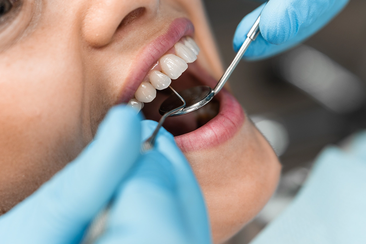 Chica en tratamiento médico bucal en clínica dental en San Baudilio de Llobregat