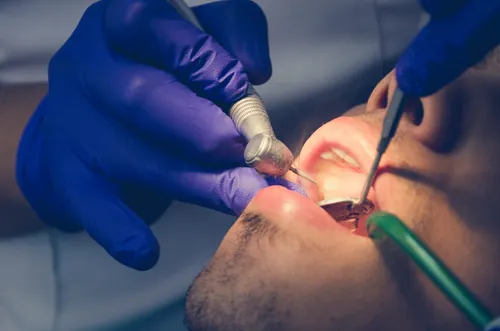 dental-chequeo-dientes-profesional-193