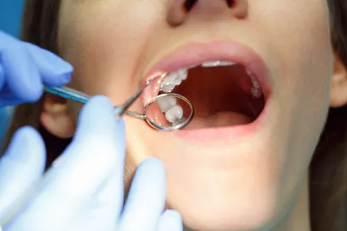 Exploración que muestra una dentadura sana y bien cuidada