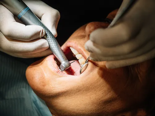 dental-turbina-espejo-revision-178