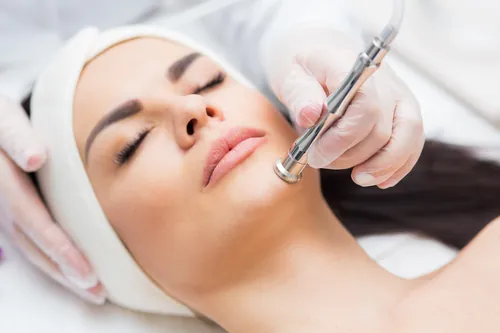 Sesión de microdermoabrasión sobre el rostro de una clienta